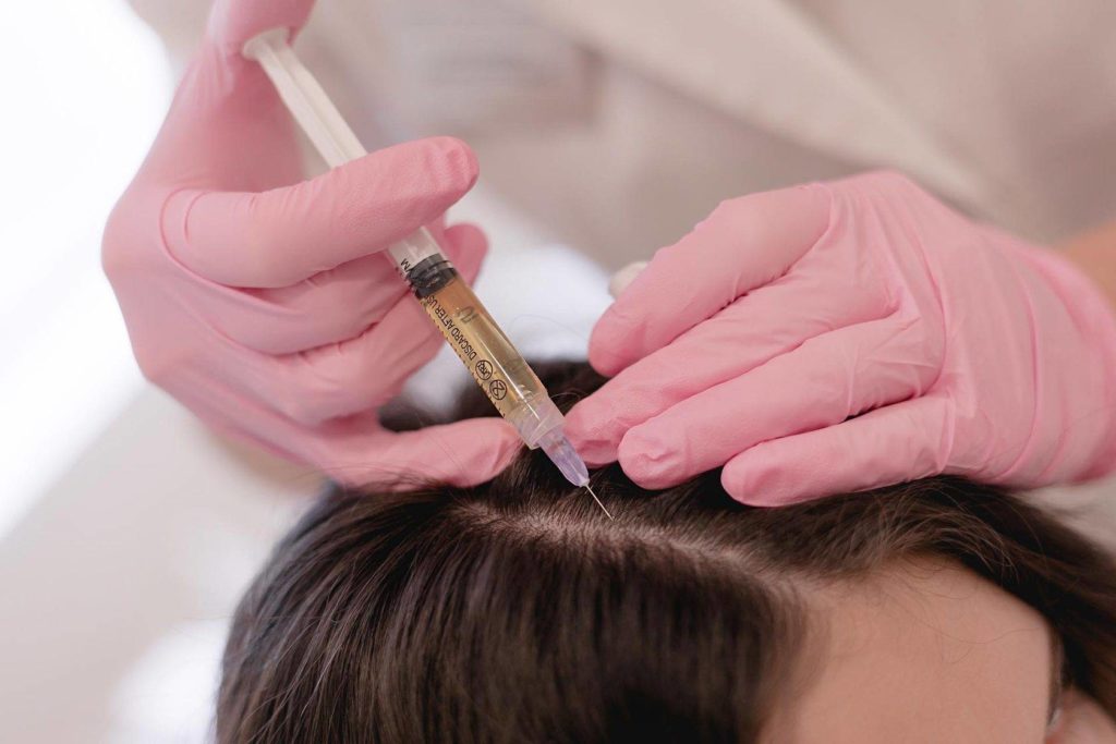 Мезотерапия для волос: принцип действия
